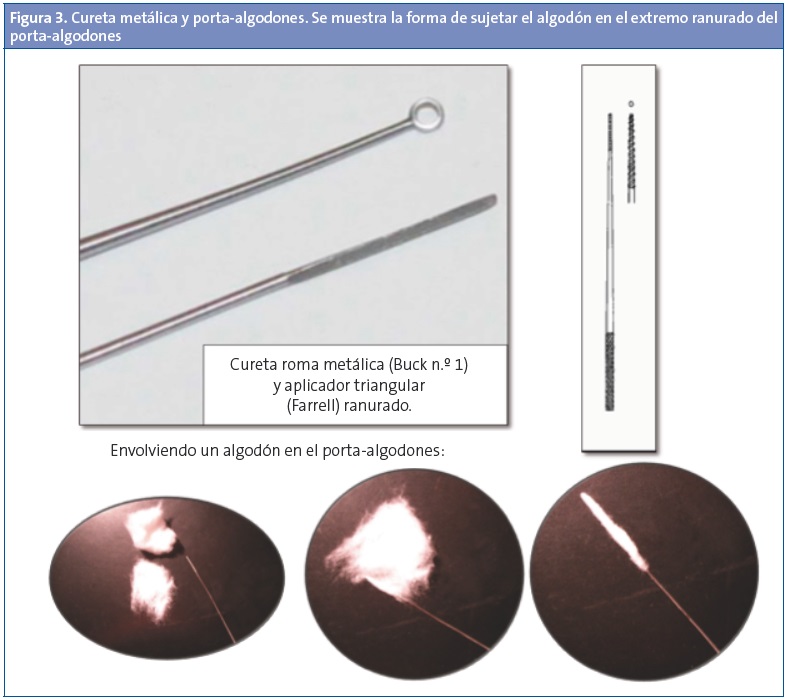 Figura 3. Cureta metálica y porta-algodones. Se muestra la forma de sujetar el algodón en el extremo ranurado del porta-algodones