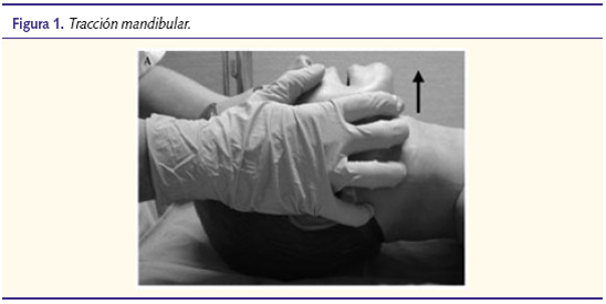 Figura 1. Tracción mandibular