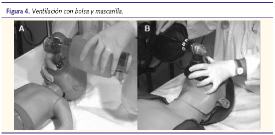 Figura 4. Ventilación con bolsa y mascarilla.
