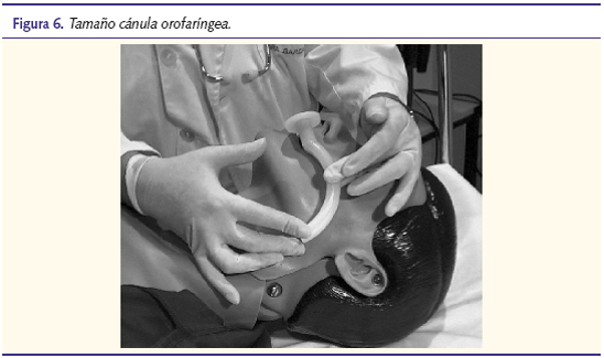 Figura 6. Tamaño cánula orofaríngea.
