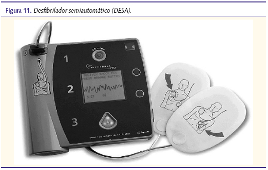 Figura 11. Desfibrilador semiautomático (DESA)