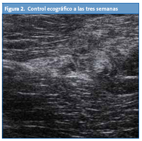 Figura 2. Control ecográfico a las tres semanas