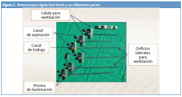 Figura 1. Broncoscopio rígido Karl Storlz y sus diferentes partes