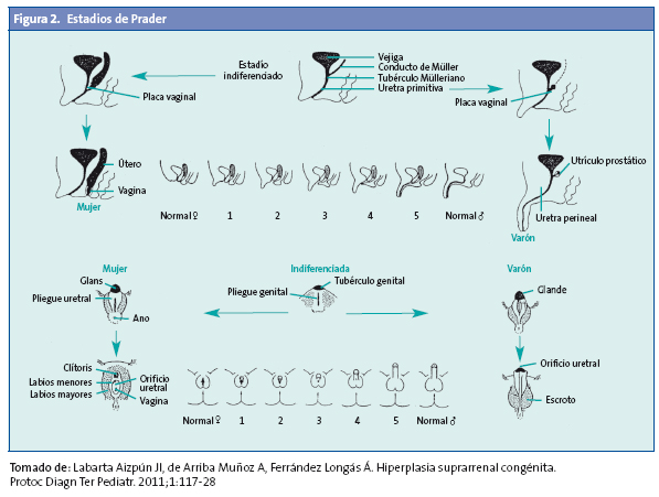 Figura 2. Estadios de Prader