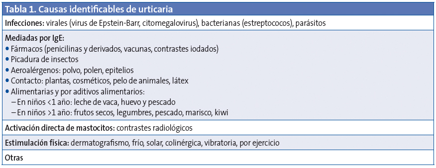 Tabla 1. Causas identificables de urticaria