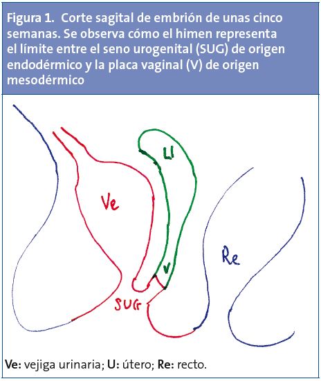 Figura 1. Corte sagital de embrión de unas cinco semanas. Se observa cómo el himen representa el límite entre el seno urogenital (SUG) de origen endodérmico y la placa vaginal (V) de origen mesodérmico