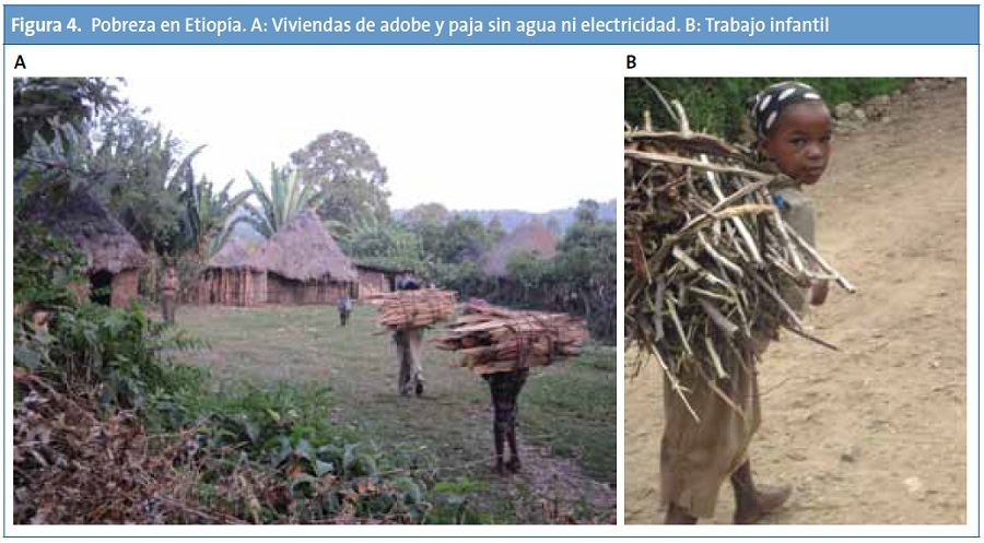 Figura 4. Pobreza en Etiopía: A. Viviendas de adobe y paja sin agua ni electricidad. B. Trabajo infantil