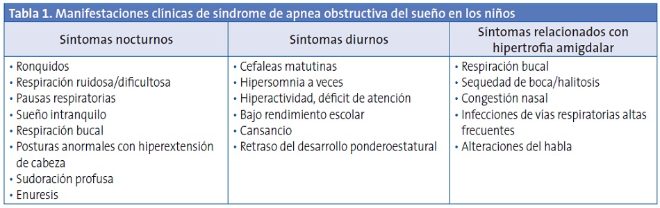 Tabla 1. Manifestaciones clínicas de síndrome de apnea obstructiva del sueño en los niños