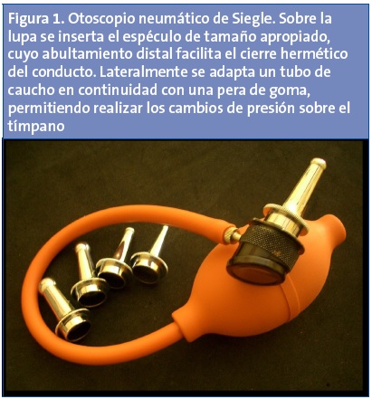 Figura 1. Otoscopio neumático de Siegle. Sobre la lupa se inserta el espéculo de tamaño apropiado, cuyo abultamiento distal facilita el cierre hermético del conducto. Lateralmente se adapta un tubo de caucho en continuidad con una pera de goma, permitiendo realizar los cambios de presión sobre el tímpano