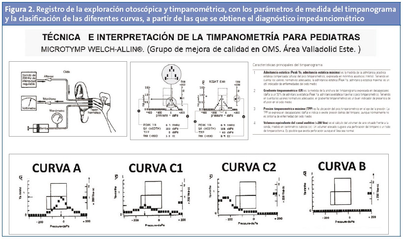 Figura 2. Registro de la exploración otoscópica y timpanométrica, con los parámetros de medida del timpanograma y la clasificación de las diferentes curvas, a partir de las que se obtiene el diagnóstico impedanciométrico.