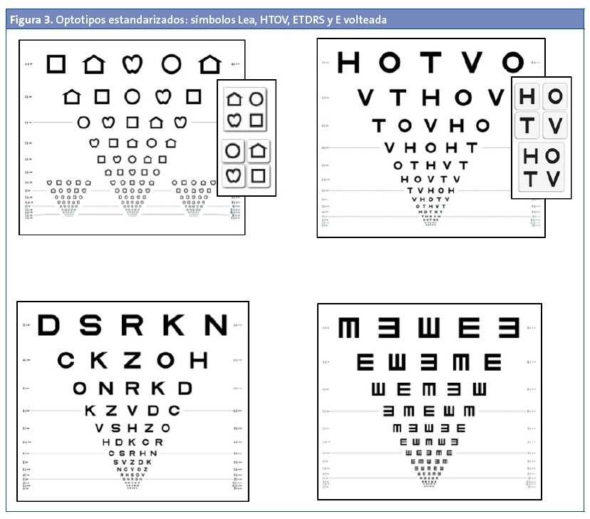 Rev Pediatr Aten Primaria. 2016;18:00-00 ISSN: 1139-7632 • www.pap.es 4 y puede dar lugar a la obtención de mejores resultados. Los optotipos estandarizados con letras, como los de Sloan o los ETDRS, son adecuados partir de los seis años o cuando el niño