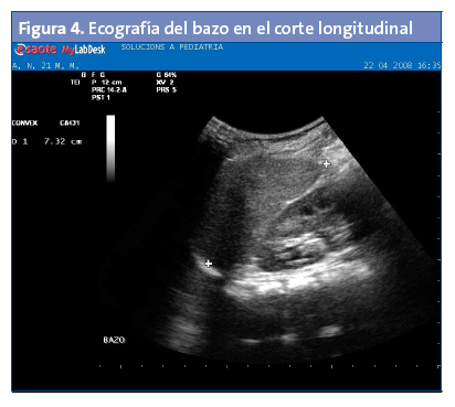 Figura 4. Ecografía del bazo en el corte longitudinal