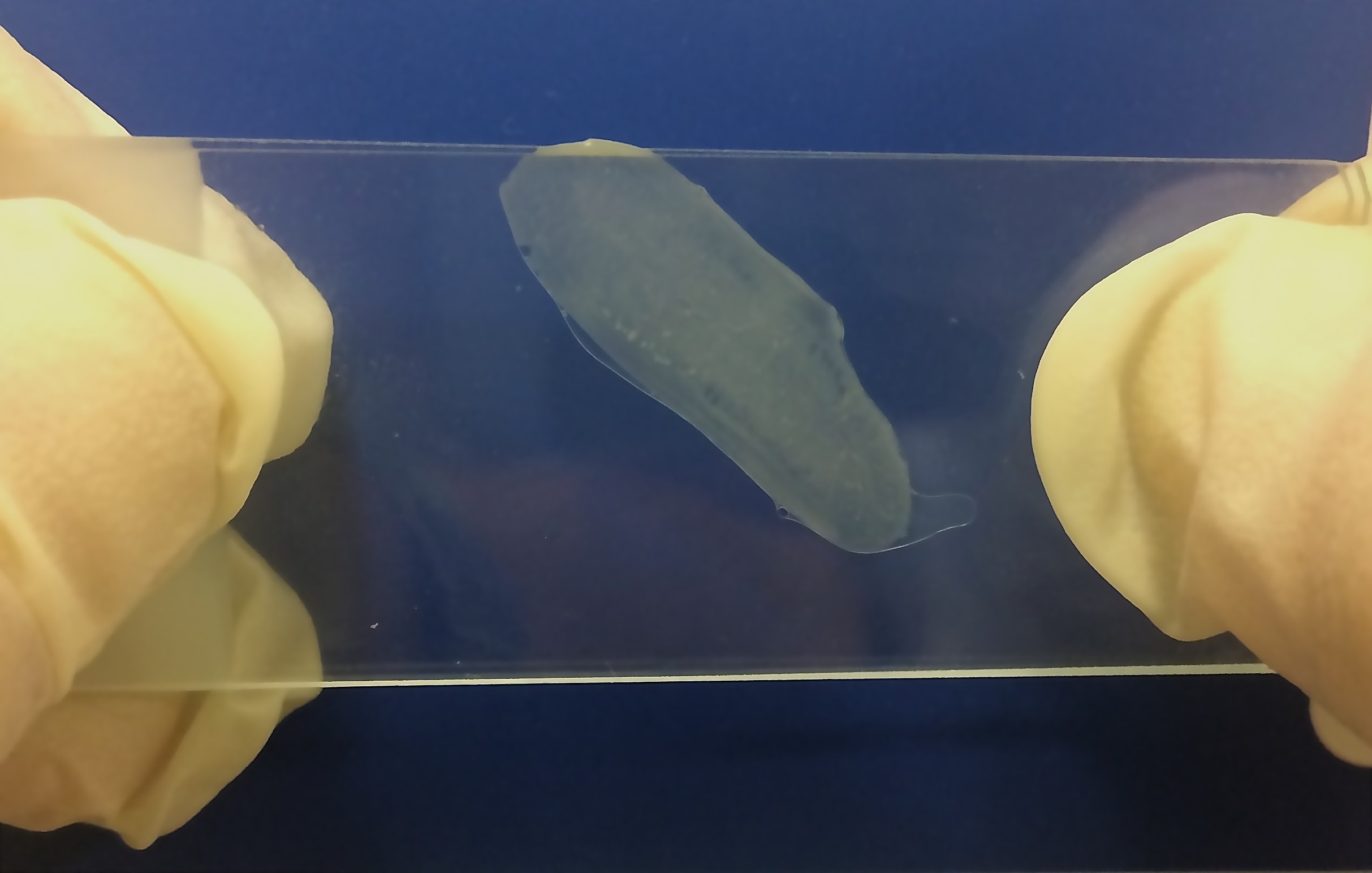 Figura 1. Detalle de proglótide de <em>Taenia saginata</em> extraído de las heces de la paciente entre portas sin tinción