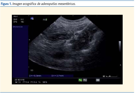 Figura 1. Imagen ecográfica de adenopatías mesentéricas.