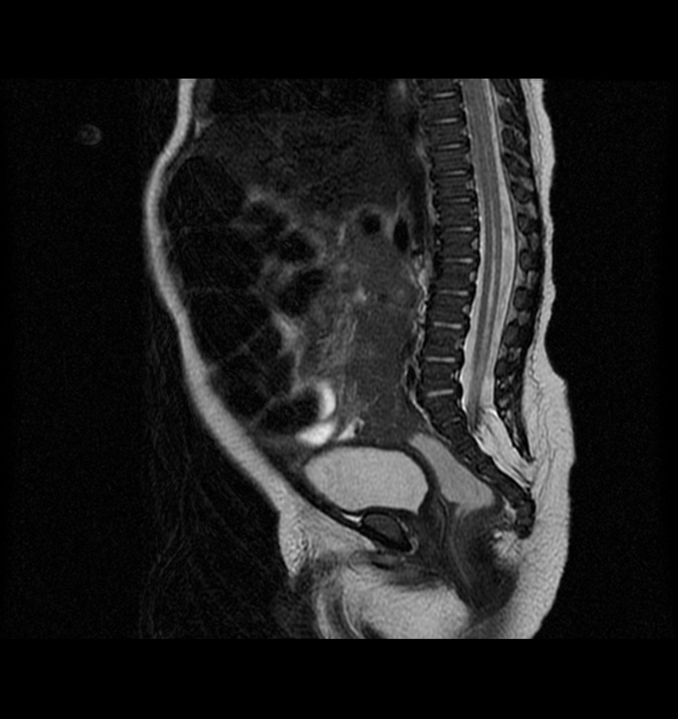 Figura_2></td>
			</tr>
		</tbody>
		 <caption align=