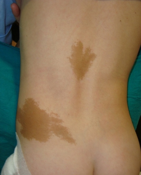 Mancha café con leche