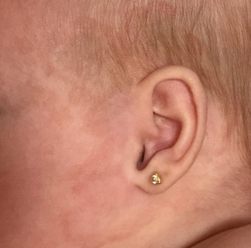 Lesiones_en_fase_de_resolución