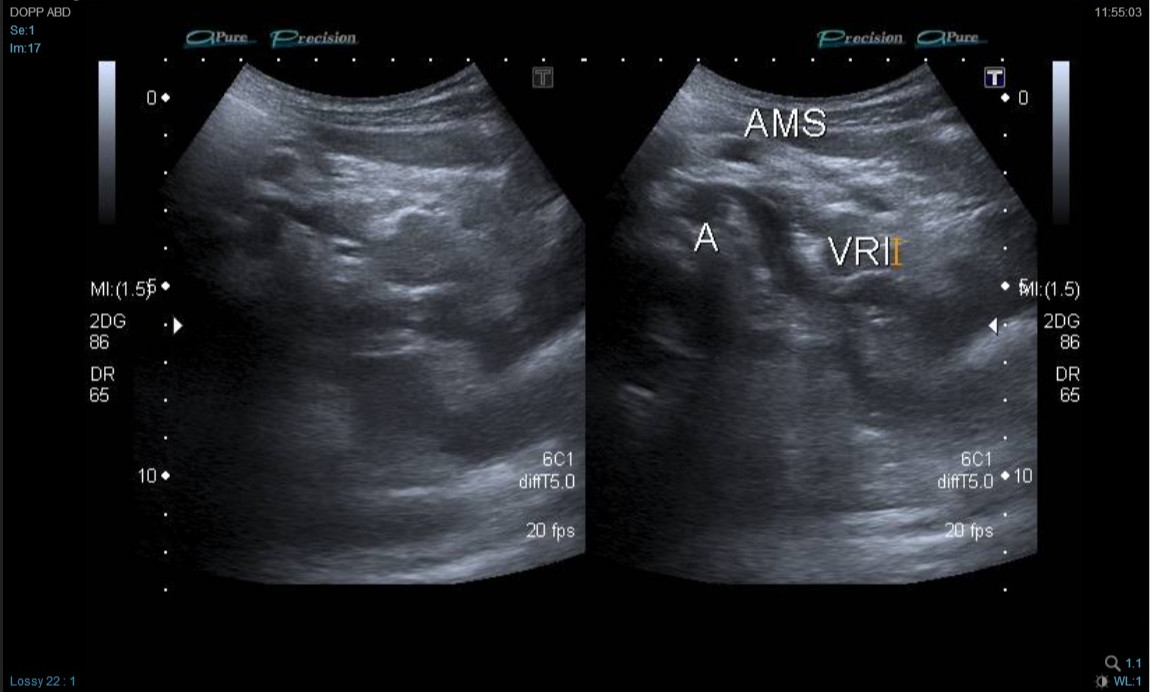 Imagen ecografía Doppler