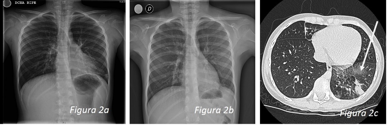 Figura 2. Caso clínico 2