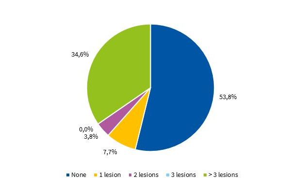 Distribution of children in year 1 of preschool by presence of caries in deciduous teeth
