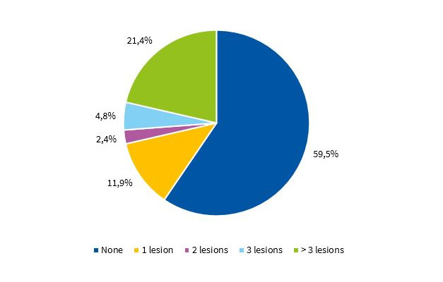 Distribution of children in year 2 of preschool by presence of caries in deciduous teeth