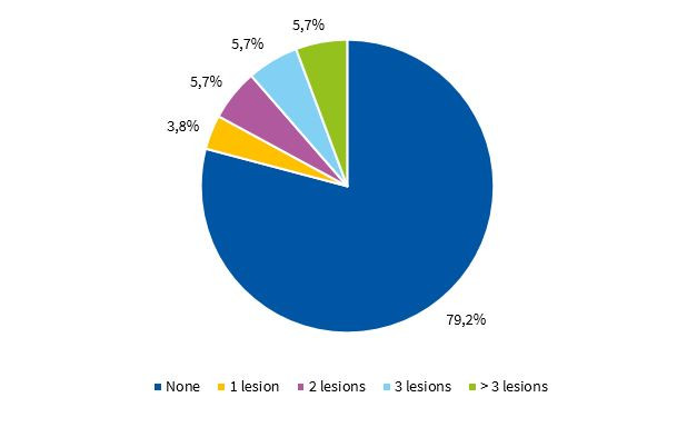 Distribution of children in year 2 of preschool by presence of caries in permanent teeth