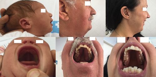 Caso 2: recién nacido, madre y abuelo