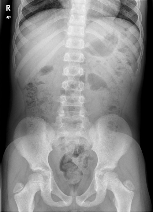 Figura 2. Luminograma inespecífico