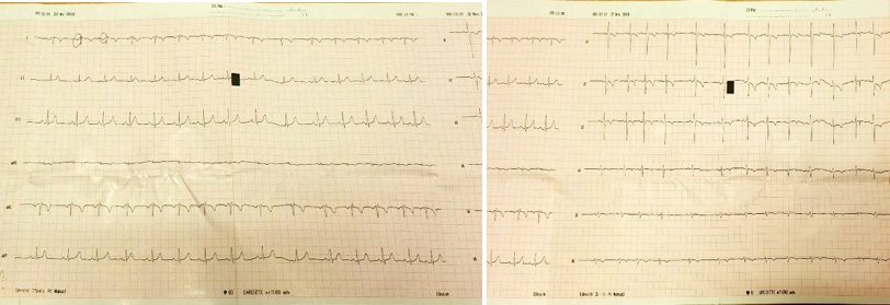 Primer ECG
