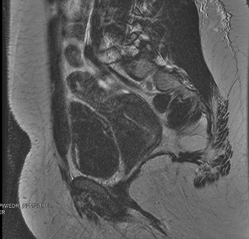 Figura 2. Resonancia magnética