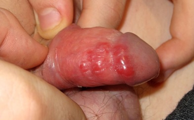 Figura 1. Imágenes obtenidas en consulta de Dermatología.