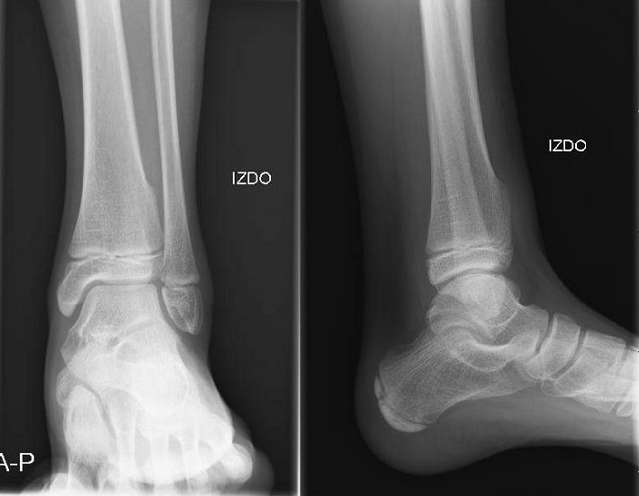 Figura 1. Radiografía