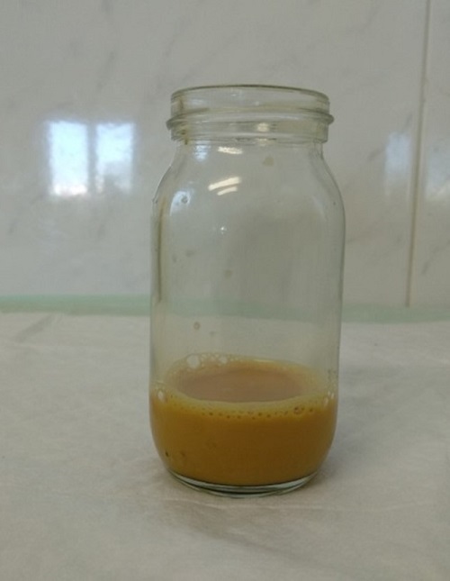 Figura 2. Síndrome de rusty-pipe o de las tuberías oxidadas: aspecto de la leche extraída (día 3)