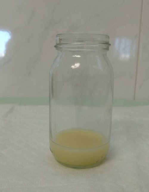 Figura 3. Síndrome de rusty-pipe o de las tuberías oxidadas: aspecto de la leche extraída (día 6, con aspecto normal)