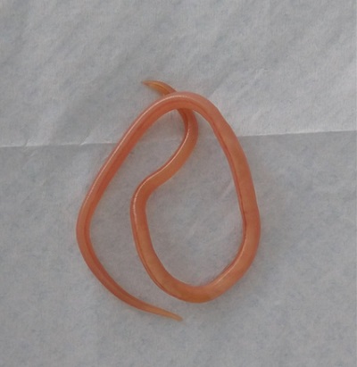 Figura 1. Ascaris lumbricoides eliminado por la paciente