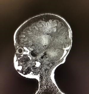 Figura 1. RMN de columna.