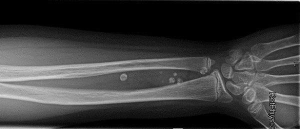 Figura 1. Radiografía