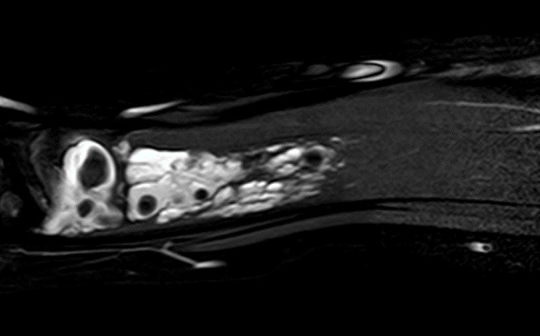 Figura 2. Resonancia magnética