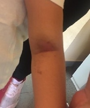 Figura 1. Imagen tomada a su llegada