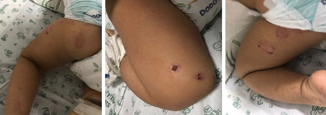 Figura 2. Evolución favorable. 