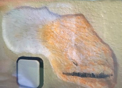 Figura 1. Imagen de una pared dañada por un paciente con pica. Se pueden observar las huellas de dentición marcadas en la misma