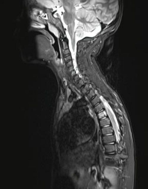 Figura 4. Resonancia magnética nuclear