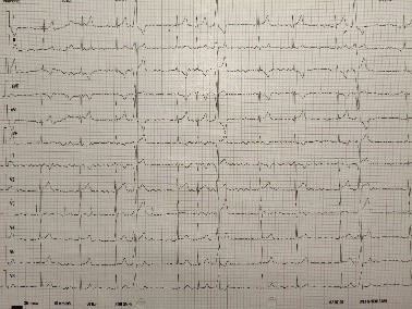 Figura 1. Electrocardiograma