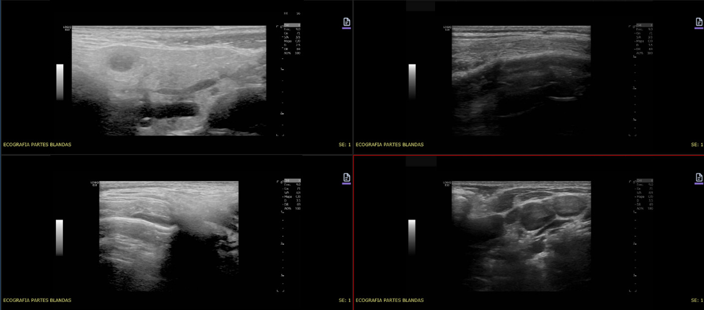 Figura 1. Ecografía