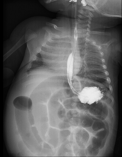 Figura 1. Tránsito gastrointestinal