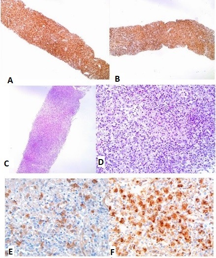Figura 2. Imágenes del estudio histopatológico
