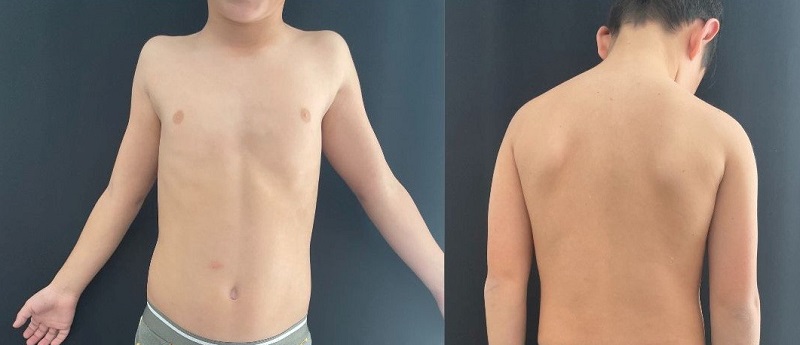 Figura 2. Resolución completa de las lesiones