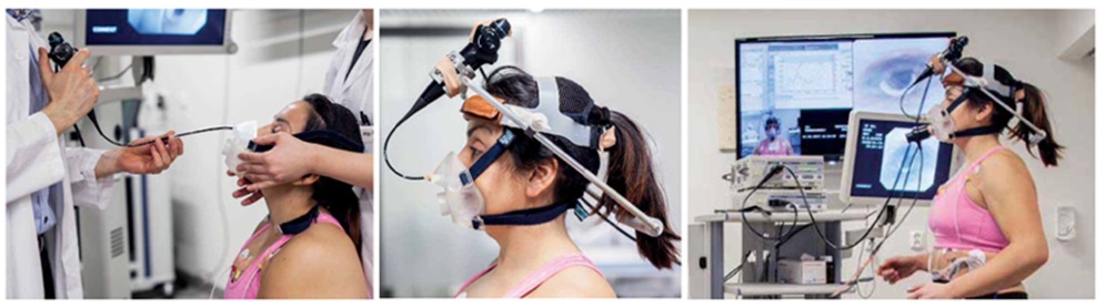 Figura 2. Laringoscopia continua durante el ejercicio para diagnóstico de obstrucción laríngea inducible por ejercicio 