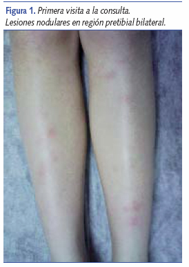 Primera visita a la consulta. Lesiones nodulares en región pretibial bilateral